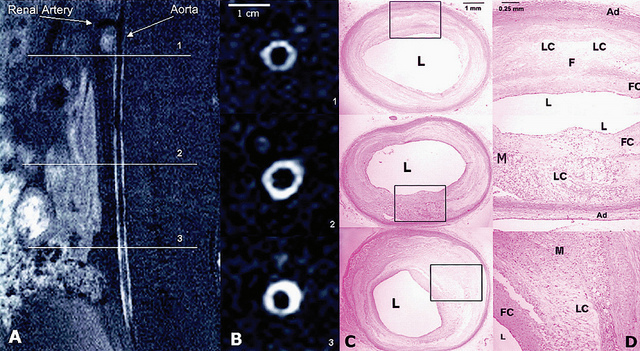 googlepill-nanoparticles