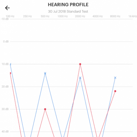 Les écouteurs sans fil Audeara A-01 peuvent-ils aider avec la perte d'audition de la vieillesse? (Review and Giveaway) profil auditif audeara casque 503x500